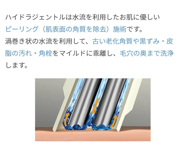 ハイドラジェントルの説明