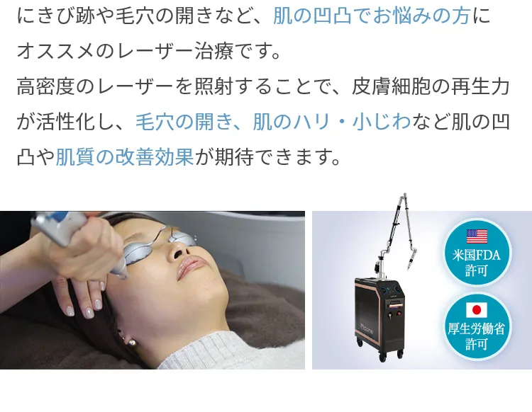ピコレーザーの説明