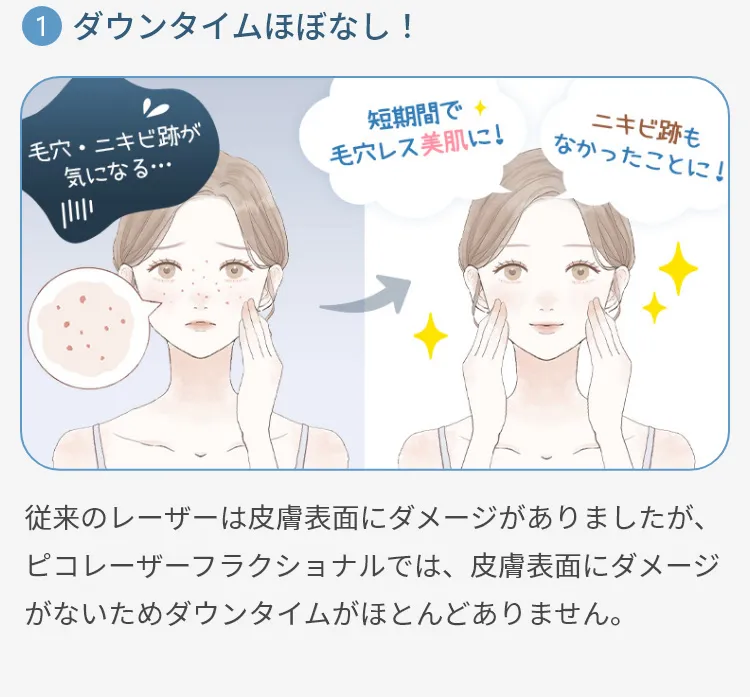１：ダウンタイムほぼなし