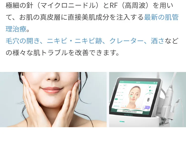 ポテンツァの説明