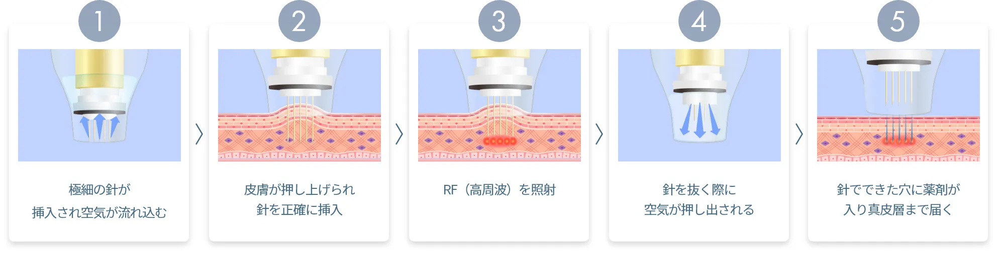 5ステップ