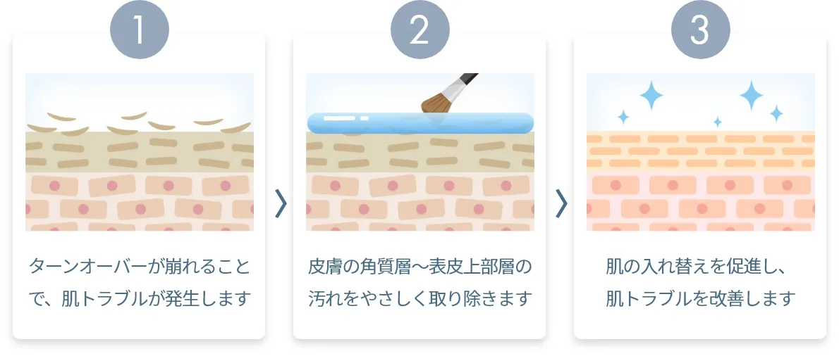 3ステップ