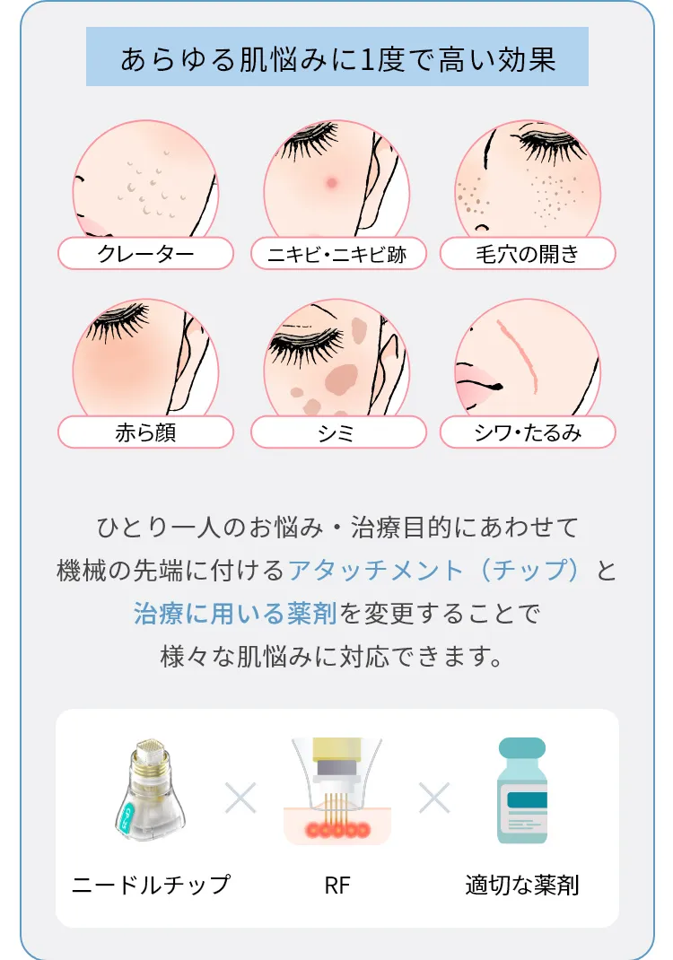 ポテンツァの効果1