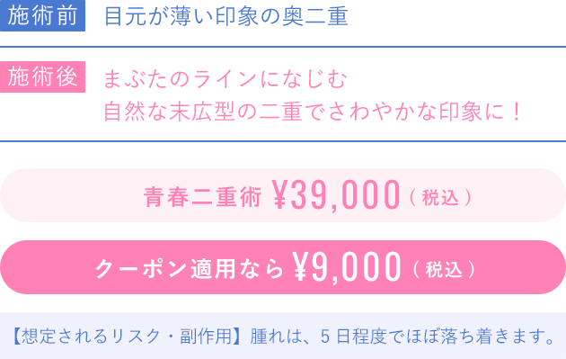 青春二重術39000円