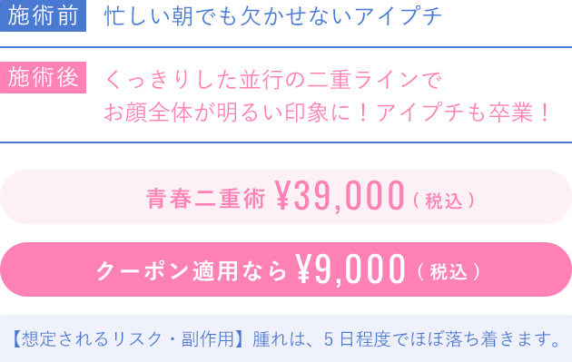 青春二重術39000円