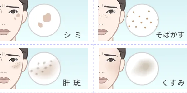 シミ・そばかす・肝斑・くすみ