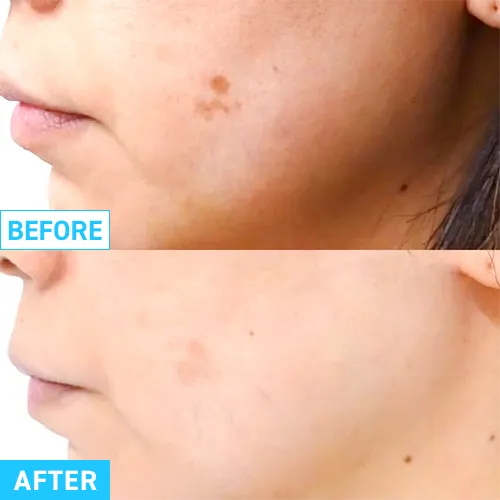 ケース01症例写真