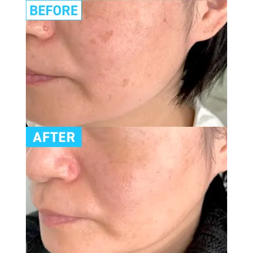 ケース02症例写真