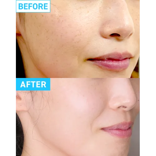 ケース03症例写真