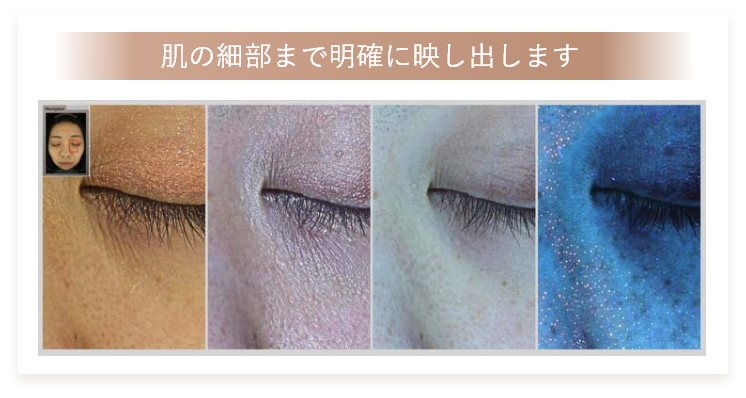 肌の細部まで明確に映し出します