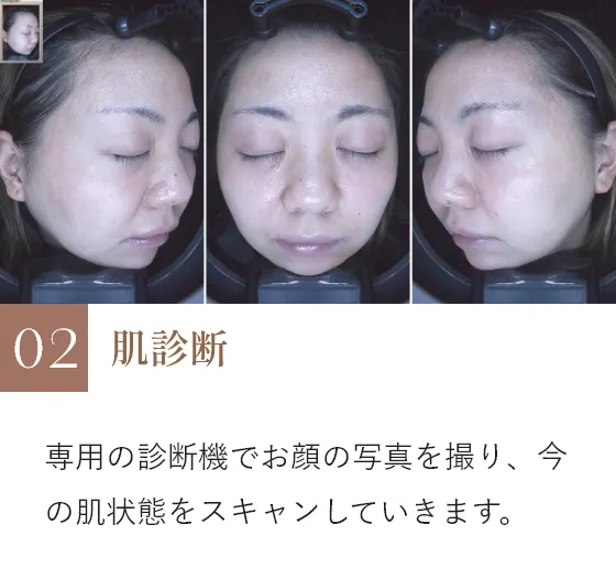 肌診断
