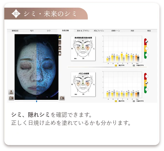 シミ・未来のシミ