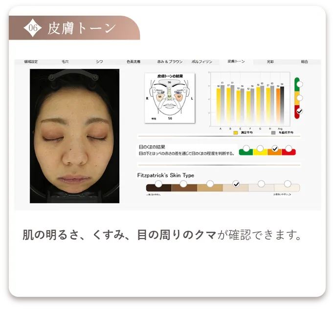皮膚トーン