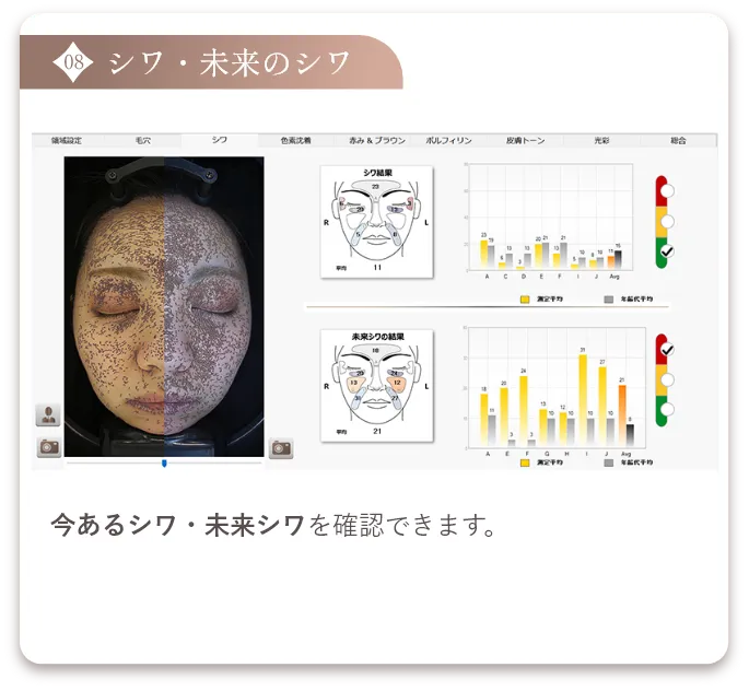 シワ・未来のシワ