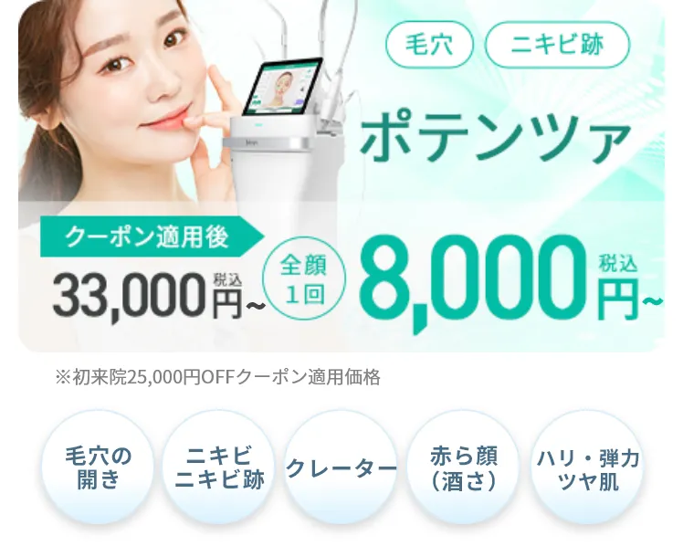 ポテンツァ