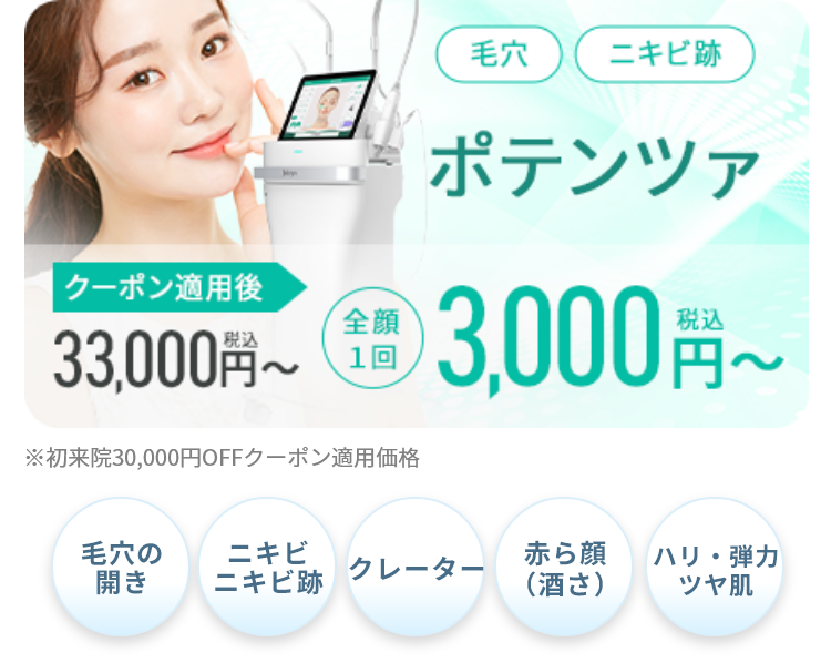 ポテンツァ