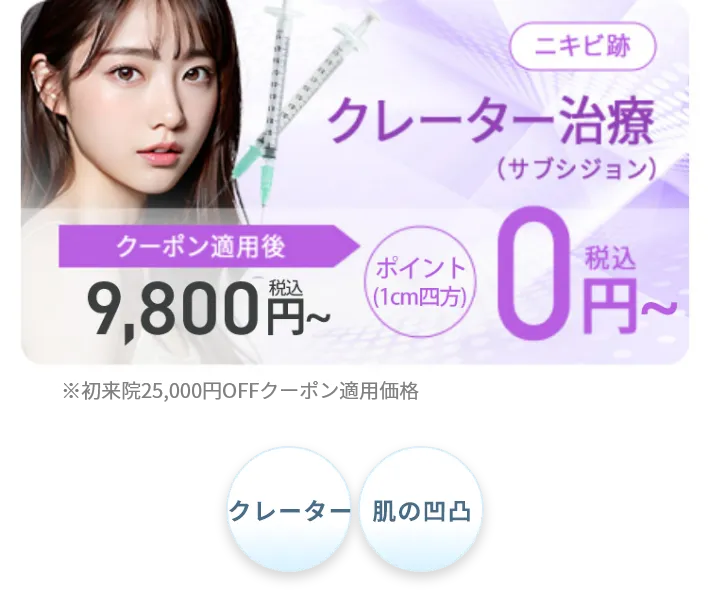サブシジョン