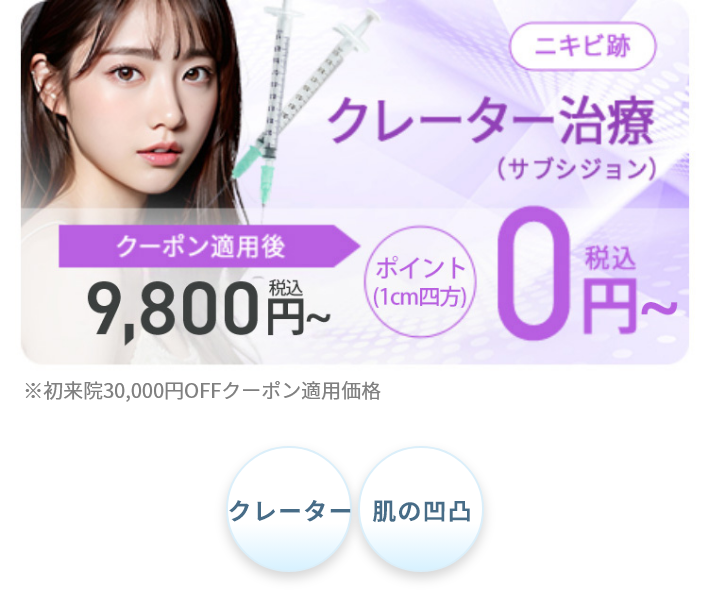 サブシジョン