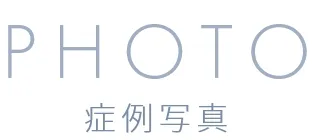 CASE 症例写真