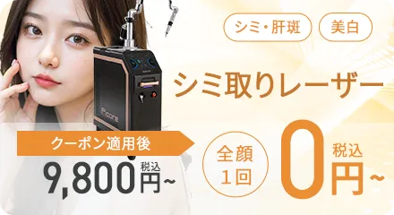 シミ取りレーザー