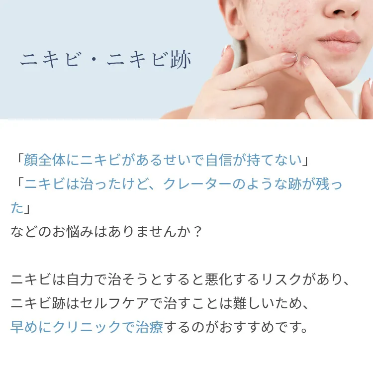 ニキビ・ニキビ跡