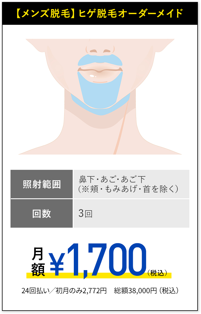 メンズ脱毛、ヒゲ脱毛オーダーメイド