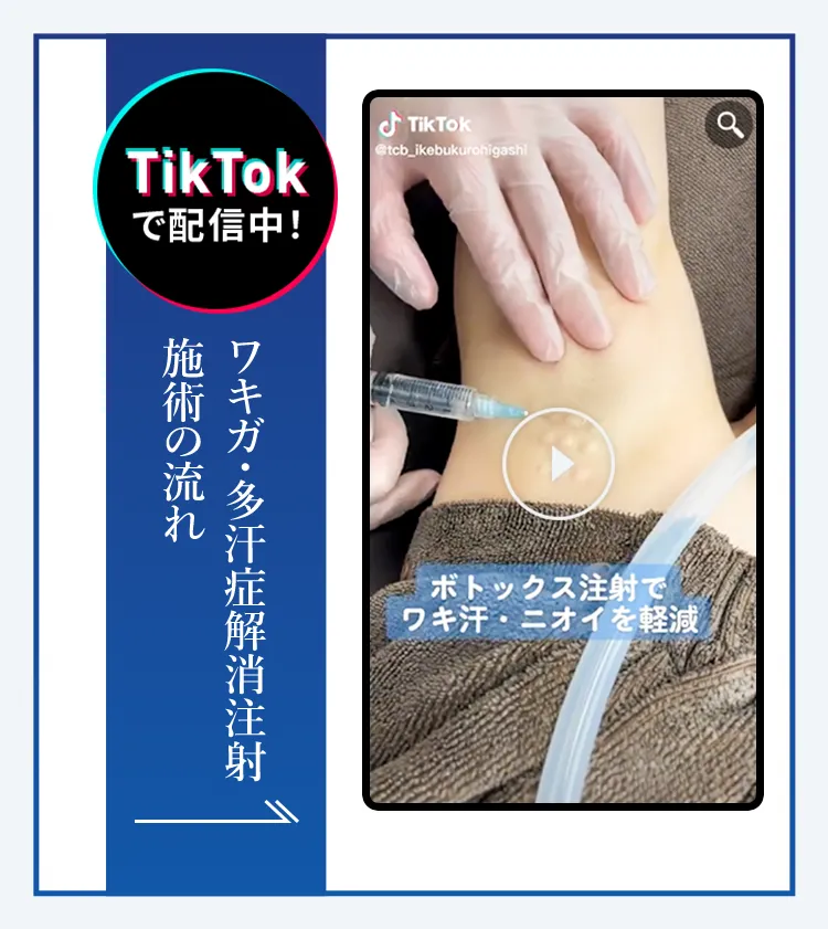 TikTokで配信中 ワキガ・多汗症解消注射 施術の流れ