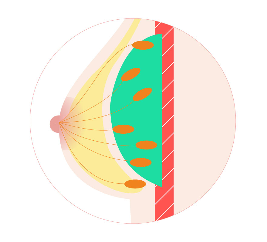 脂肪幹細胞豊胸術イメージ