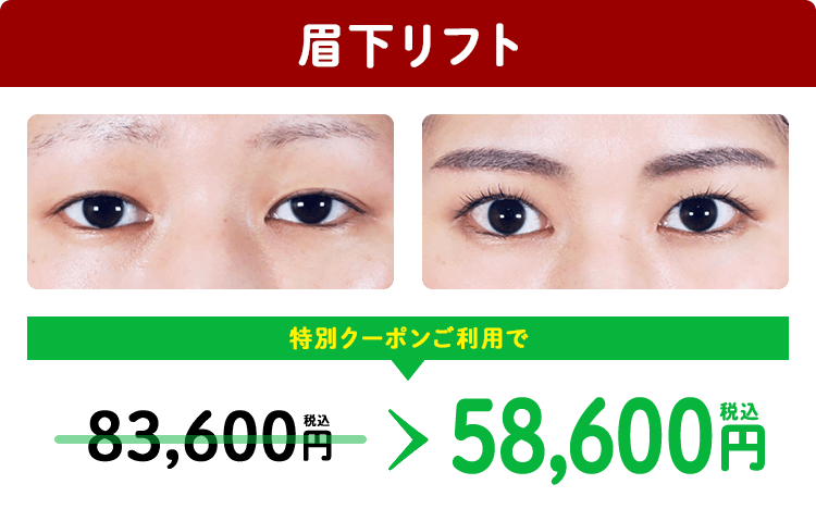 LINEクーポン