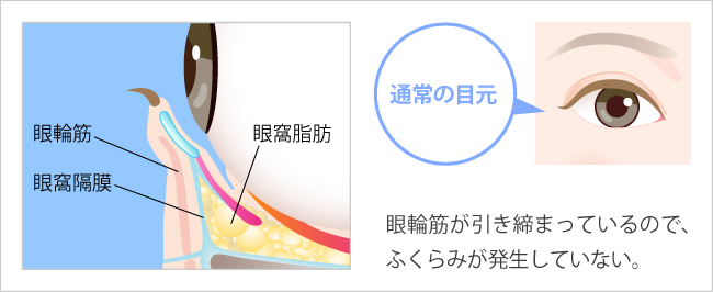 目の下のふくらみが発生する仕組みのイラスト