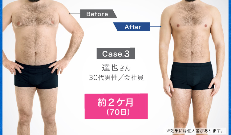 case.3 達也さん 30代男性／会社員 約2ヶ月（70日）-12.5kg達成！
