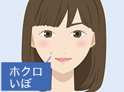 いぼを取りたい!